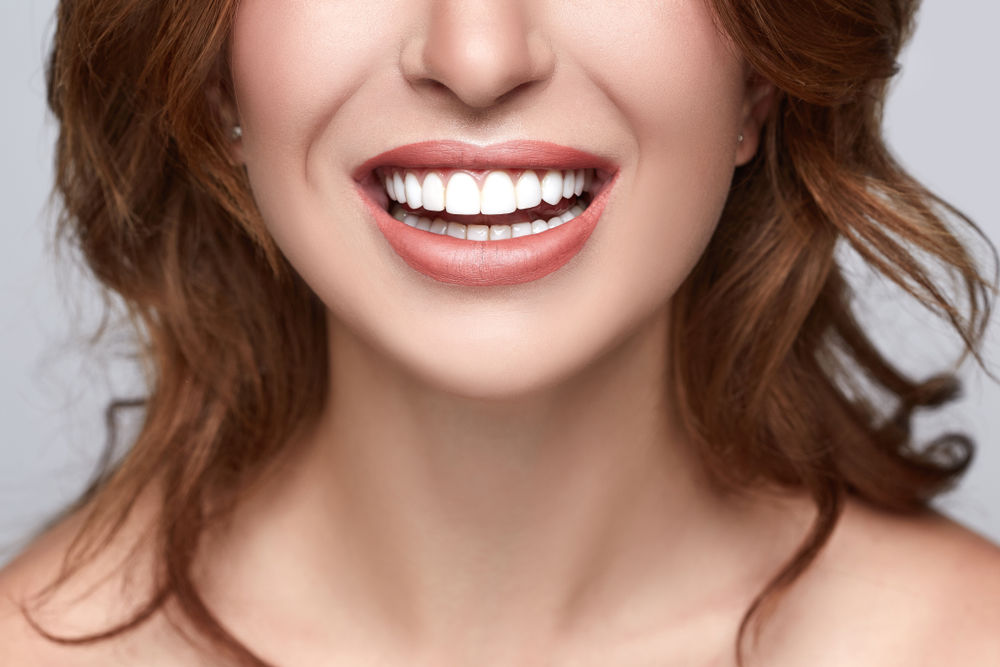 smiling young woman cosmetic dentist harrisonburg va