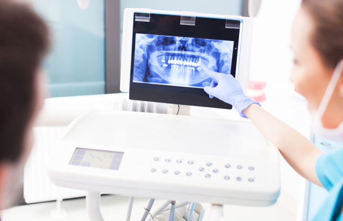 Dentist in Harrisonburg with Dental X-ray